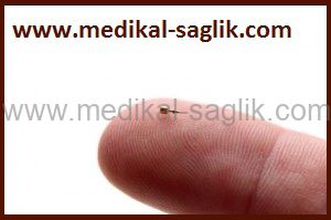 Akupunktur Ignesi Asp Kulak Akupunktur Ignesi Kalici Asp Akupunktur Ignesi Kalici Kulak Akupunktur Ignesi Www Medikal Saglik Com