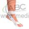 CASE BANDAJ TİPİ GECE ATELİ_HALLUKS VALGUS ATELİ